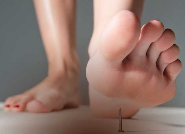 Семилетняя девочка заболела столбняком на Львовщине