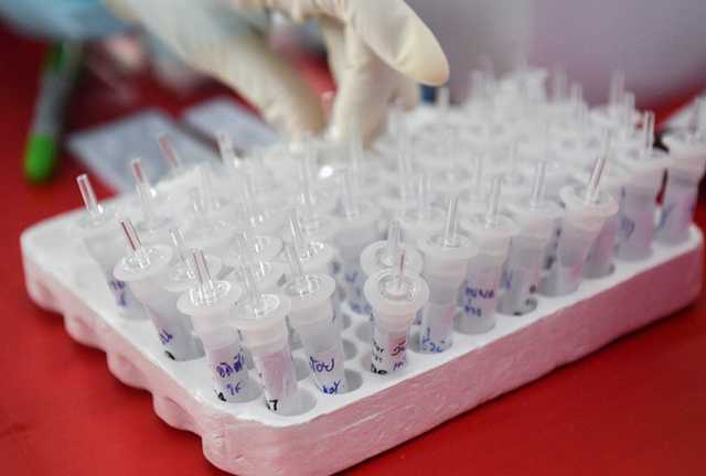 Около 90% COVID-случаев в Чехии вызваны штаммом "Дельта"