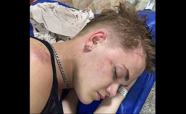 Личность человека жестоко избившего танцора украинской певицы установлена