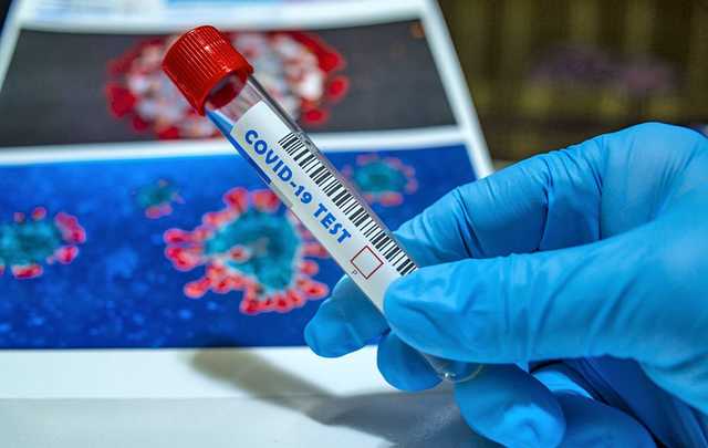 В Украине 619 новых случаев коронавируса за сутки