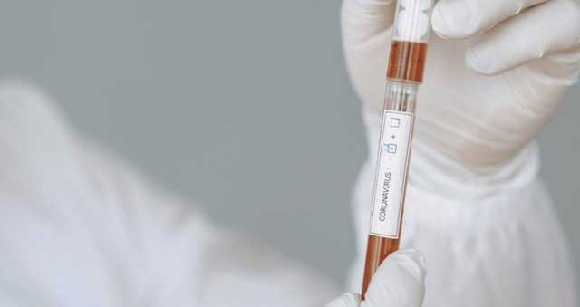 В Украине за сутки зафиксировано 300 новых случаев COVID-19