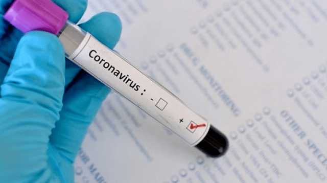 "Дельта"-штамм коронавируса обнаружили в Черниговской области