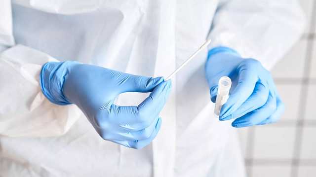 В России зафиксировали симптом "коронавирусных пальцев"