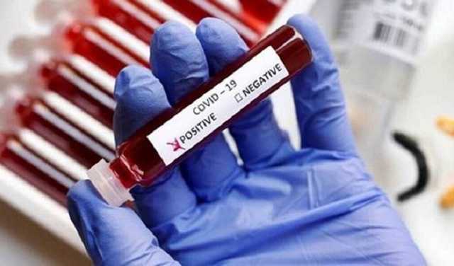    16,3 .   COVID-19  ,  838 