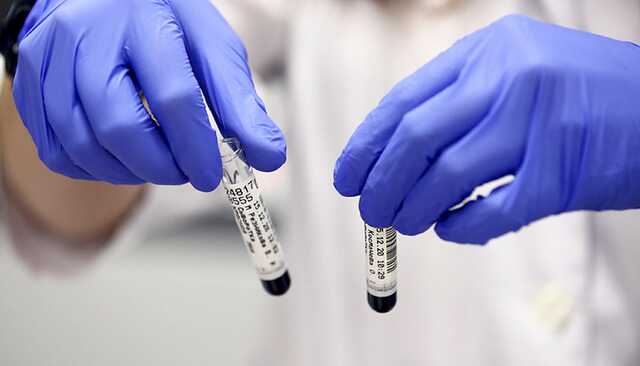 В Украине может быть два случая Омикрона: заболели мужчина и женщина из Киева