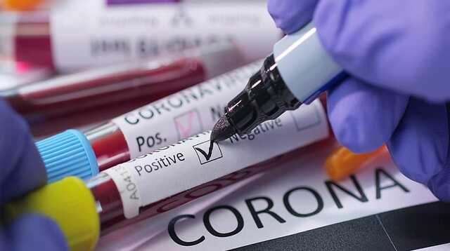 «Последние всплески коронавируса»: пандемия уже идет к завершению — вирусолог