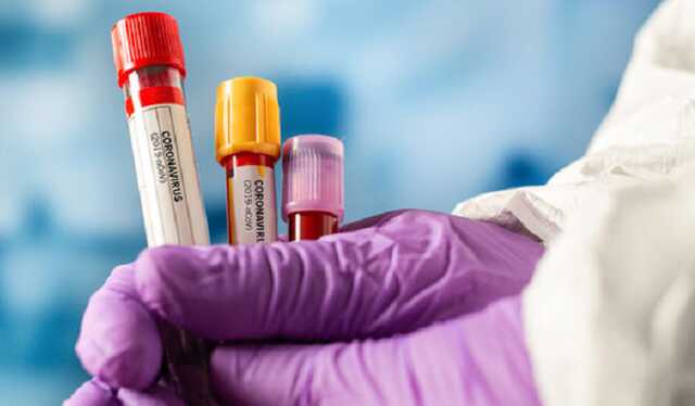 Уже в двух областях COVID-показатель соответствует "зеленому" уровню эпидопасности