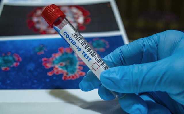 В Чехии введут обязательное тестирование на коронавирус для работников