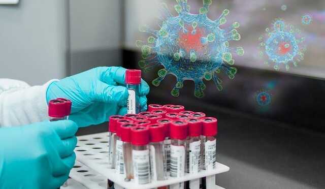 Во Франции обнаружили новый штамм коронавируса родом из Камеруна