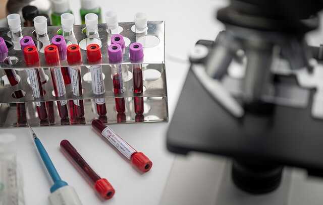 В Украине свыше 4,5 тыс. новых случаев COVID-19, умерли 273 человека