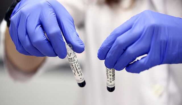 В ВОЗ сообщили причину возникновения "дельтакрона" и призвали не использовать это название