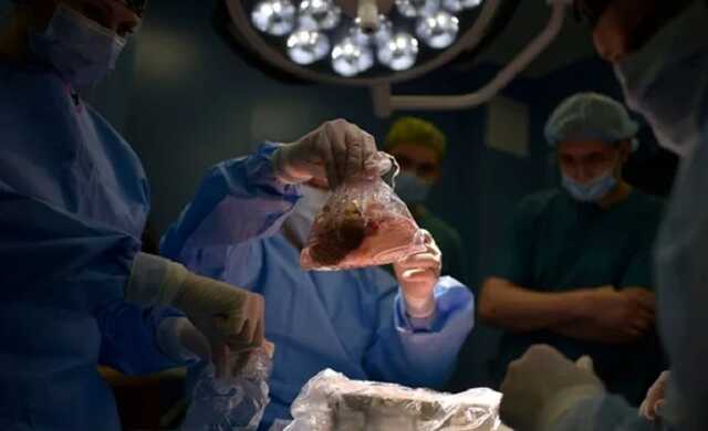 Впервые в Украине: во Львове годовалому ребенку пересадили печень