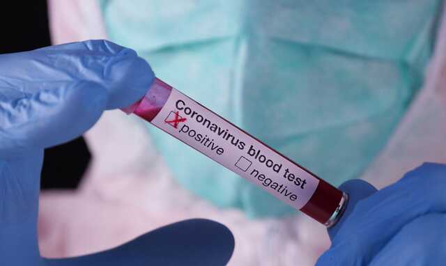 Алжир зафиксировал первый случай заражения новым вариантом "Омикрона"