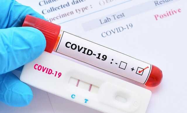 Положительный тест на COVID. Минздрав рассказал, как защитить тех, с кем живете