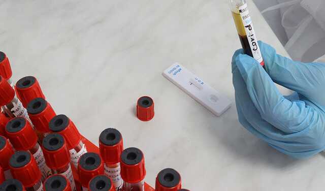 В Украине обнаружили еще более 20 тысяч случаев COVID