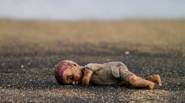 В Ахтырке умер ребенок, пострадавший в результате обстрела детсада, – СМИ