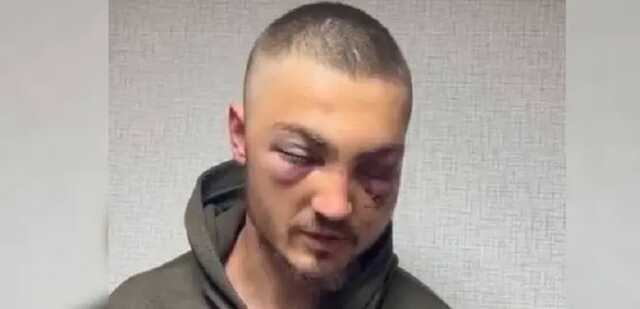 «Синяки сам заработал, наступив на грабли»: Кадыров похвастался пытками украинских пленных