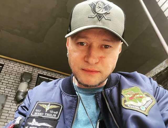 Хлывнюк впервые признался, как получил ранение в лицо: будто сбили с ног