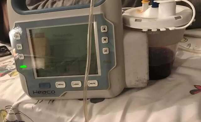 Сотни раненых: волонтеры просят помощи на покупку аппаратов ВАК