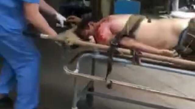 Американский доброволец рассказал, что "потерял много хороших людей" на войне