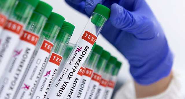 Оспа обезьян не имеет характера чрезвычайной ситуации в области здравоохранения, - ВОЗ