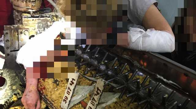 В Днепре на производстве рука женщины застряла в кондитерском станке