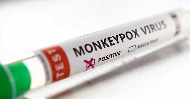 В Україні виявили перший випадок віспи мавп