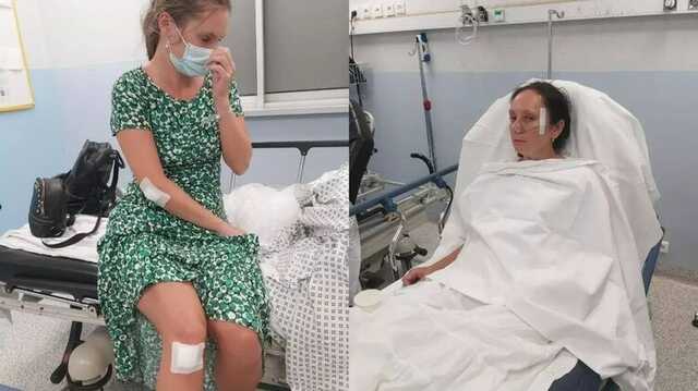 У Приморських Альпах екс-військовий з України побив двох українських біженок