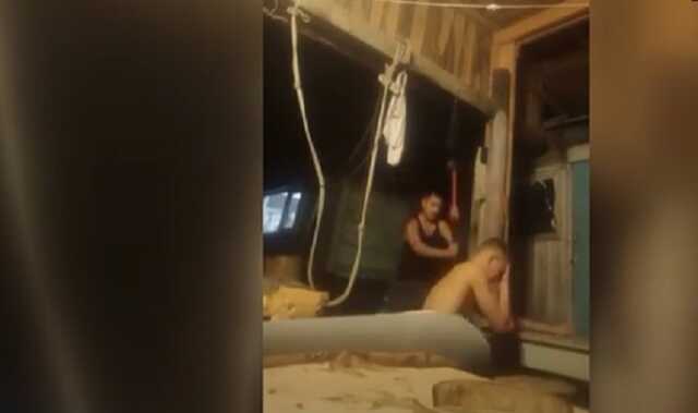 «Косять» від мобілізації: в Росії хлопцеві зламали руку велетенською кувалдою