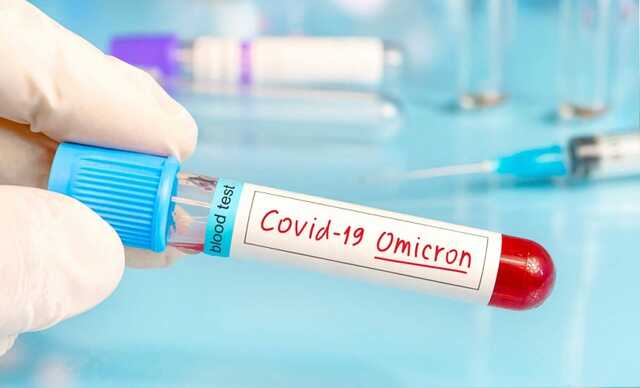    Omicron XBB.1.5     쳿