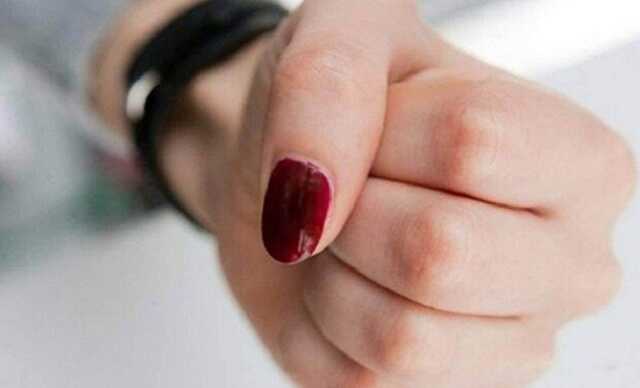 Розпивала алкоголь у під’їзді: у Львові дівчина через зауваження роздряпала нігтями обличчя жінці