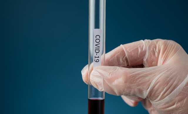   :        COVID-19 ""