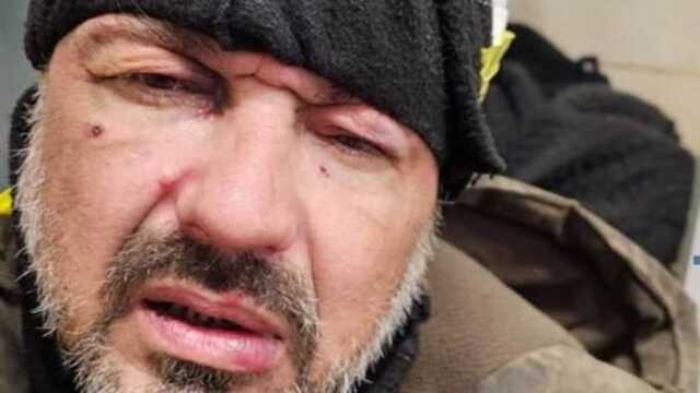 Стало відомо, хто розкидає міни-пелюстки по окупованому Донецьку