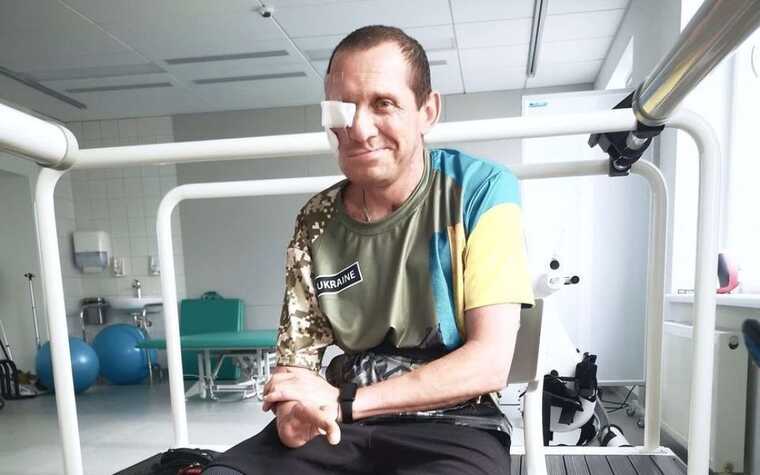 У Львові хірурги відновили обличчя військовому за допомогою титанових протезів: переніс 68 операцій