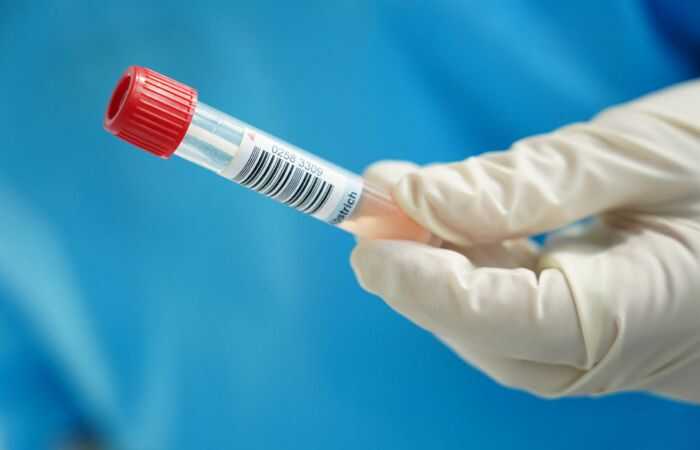 Новий штам Covid: названо 10 головних симптомів хвороби