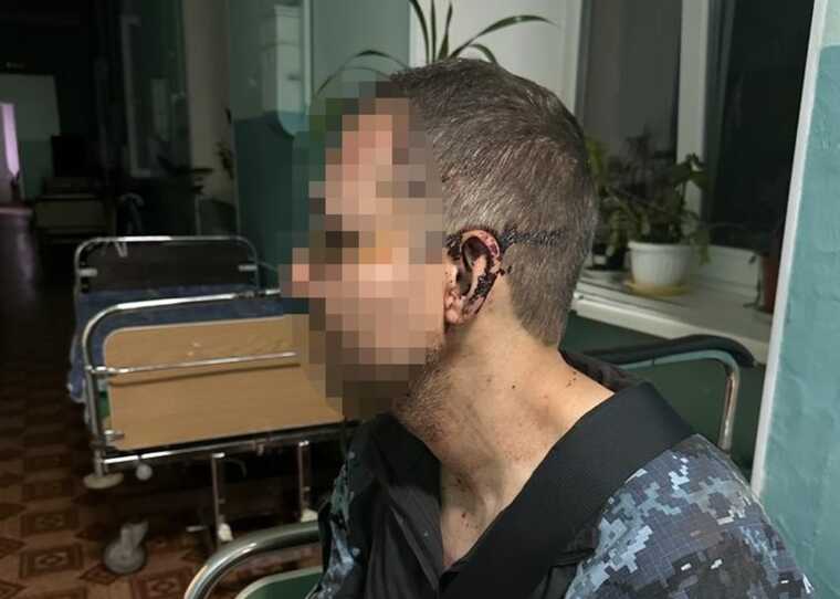 В Одесской области в одной из воинских частей избили военного, - ДБР