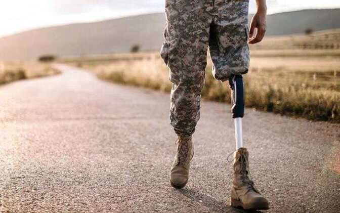 Щонайменше 25 тисяч українських військових втратили кінцівки з початку війни, – Sky News