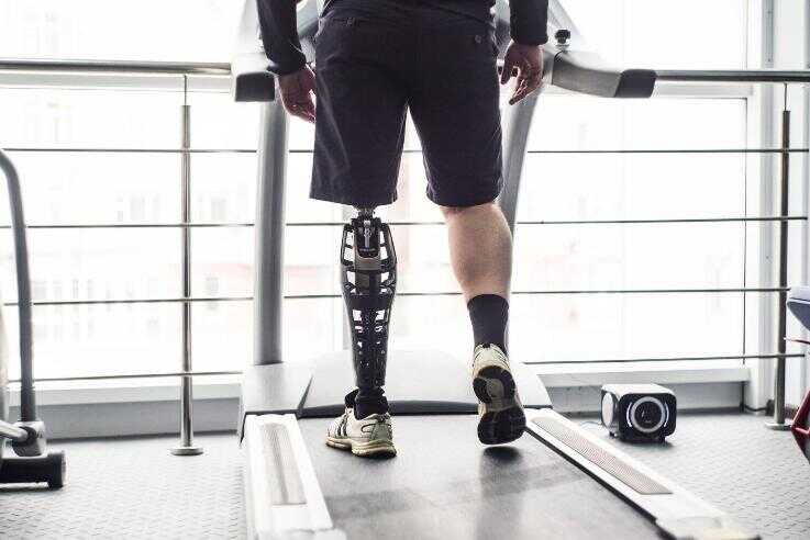В Украине ежемесячно изготовляют 2000 протезов нижних конечностей и 200 - верхних