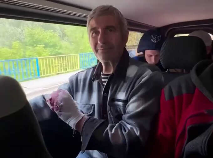 Житель Вовчанська розповів, що росіяни зайшли до його будинку та прострелили йому руку