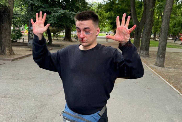 В Одесі затримали неадеквата, який ганявся з ножем за дітьми у парку