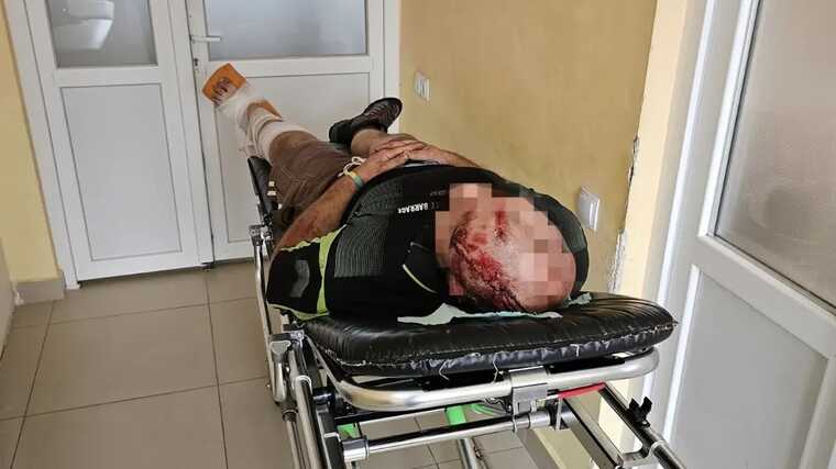 Чоловік зістрибнув із потяга "Київ-Чоп", щоб перейти кордон: зламав ногу та розбив голову