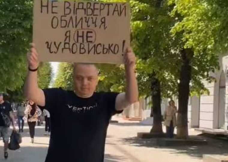 У Луцьку ветеран влаштовує акції, щоб змінити ставлення людей до поранених бійців