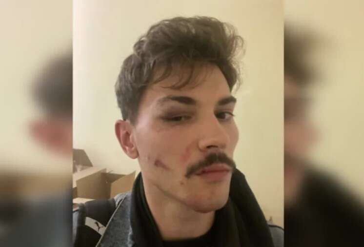 Працівники ТЦК побили студента у Львові до струсу мозку