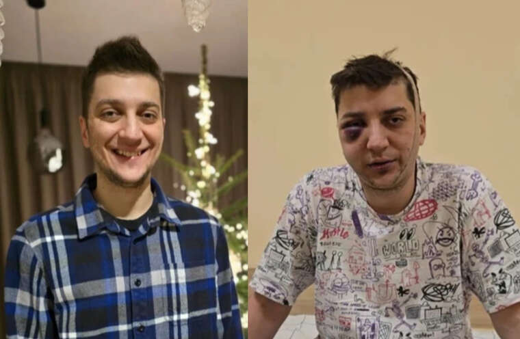 Побиття чоловіка у Гостомелі: поліція проводить розслідування щодо причетності свого співробітника до інциденту