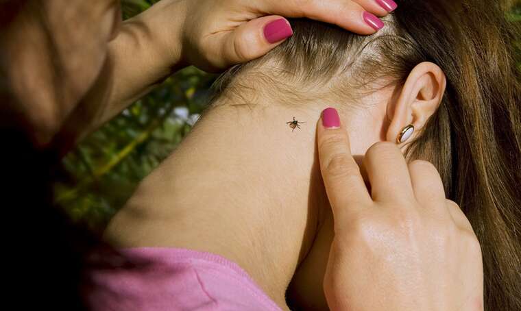 У Києві зафіксували спалах хвороби Лайма