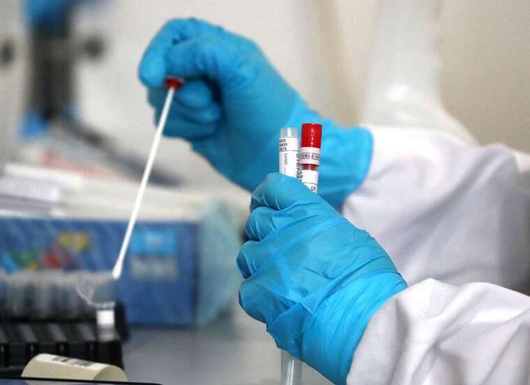 У Києві за три тижні серпня COVID-19 виявили у 2000 осіб, померли четверо