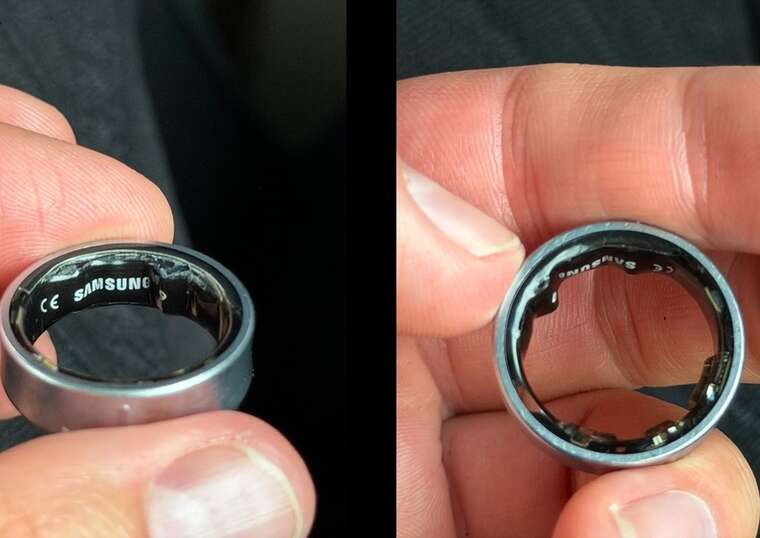 Айтівець ледь не втратив палець через акумулятор Samsung Galaxy Ring