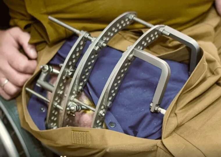 "Wounded Soldier’s Package": Ministry of Defence reports on the supply of adaptive clothing to frontline medical facilities