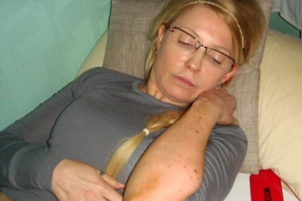 жуля-синяки dqxikeidqxidqeant