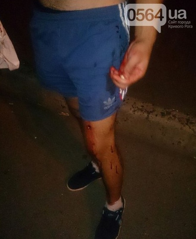 фото 0564.ua, расстреляли компанию из 4 парней dqxikeidqxidqeant